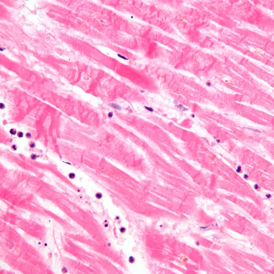 Histopathology Biopsy: Medium Specimen